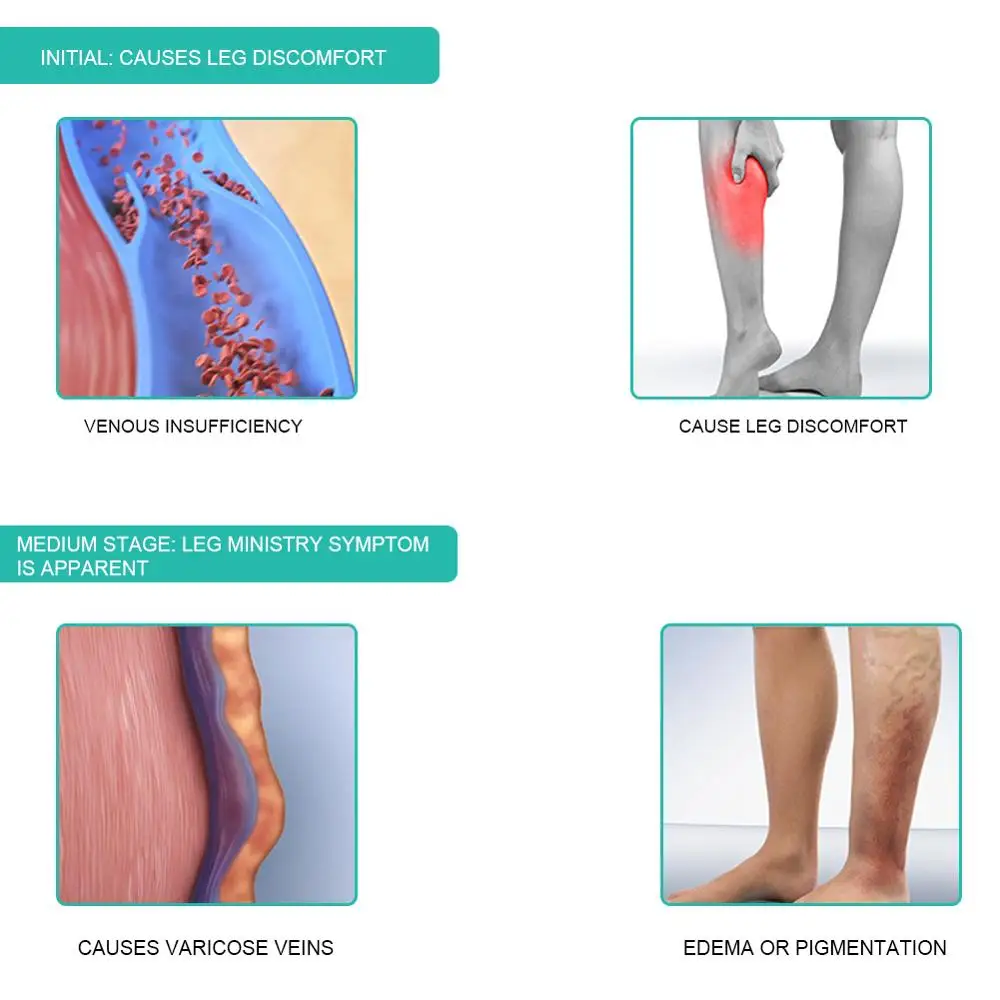 医療用着圧ソックス,1ペア,30-40mmhg,ふくらはぎス - Compression Sleeve Calf のレビューと価格