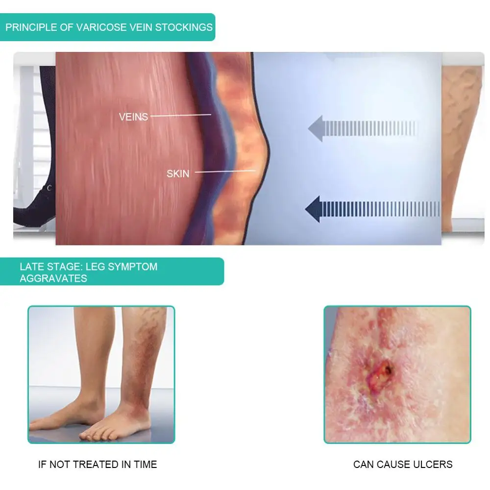 医療用着圧ソックス,1ペア,30-40mmhg,ふくらはぎス - Compression Sleeve Calf のレビューと価格